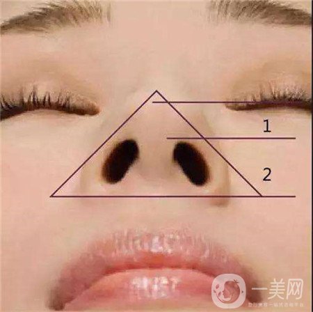 鼻頭縮小手術(shù)價(jià)錢大概是多少？