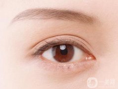 做埋線雙眼皮幾天能消腫?注意事項盤點全在這了!