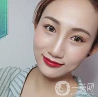 長(zhǎng)沙微恩醫(yī)療整形醫(yī)院 隆鼻