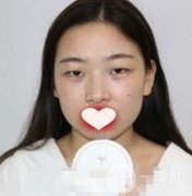 西南醫(yī)院整形美容外科價(jià)格表，附雙眼皮手術(shù)果一覽