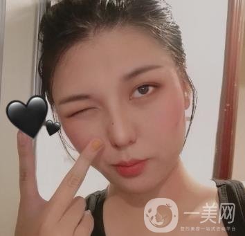六盤(pán)水友好整形醫(yī)院雙眼皮