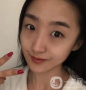 吉大一院整形外科價(jià)格表明細(xì)公布，隆鼻紀(jì)實(shí)案例分享