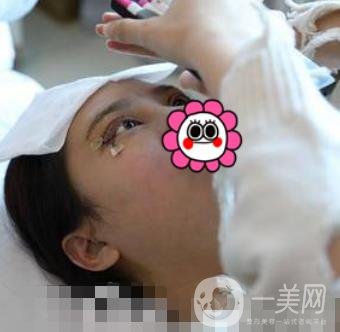 溫嶺芘麗芙整形醫(yī)院2020年價(jià)格表更新_雙眼皮整形*果實(shí)拍