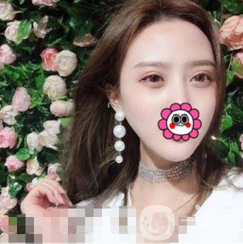溫嶺芘麗芙整形醫(yī)院2020年價(jià)格表更新_雙眼皮整形*果實(shí)拍