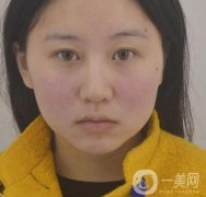 武漢市第一醫(yī)院*多少錢？美容科案例精選