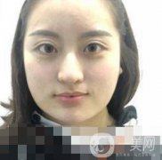 河北省人民醫(yī)院整形外科價格表新版來襲，附去下頜骨案例