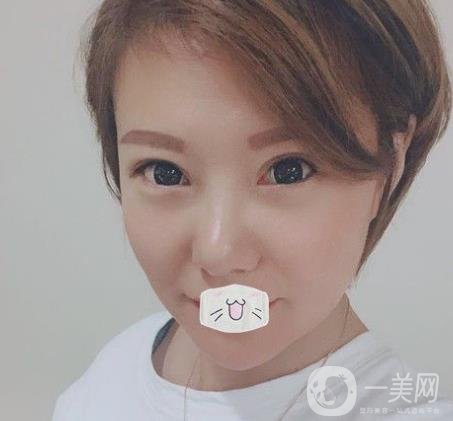 綿陽中心醫(yī)院整形美容科價格表2020發(fā)布，附祛眼袋案例