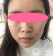 寧波第一醫(yī)院整形科價格表收費明細(xì)上線，看打玻尿酸真人案例