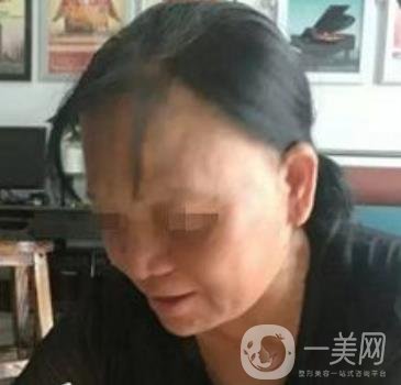 廣東省人民醫(yī)院整形科價(jià)格表，附祛斑整形日記