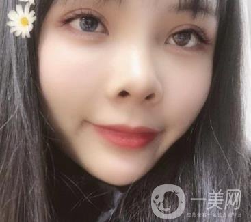 西安交通大學附屬醫(yī)院整形美容科價格表和雙眼皮案例一覽
