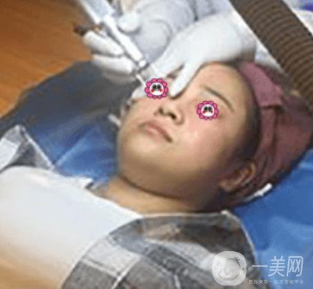 岳陽(yáng)市第一人民醫(yī)院整形美容科祛斑好嗎？?jī)r(jià)格表和案例日記分享