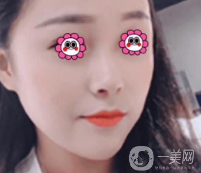 岳陽(yáng)市第一人民醫(yī)院整形美容科祛斑好嗎？?jī)r(jià)格表和案例日記分享
