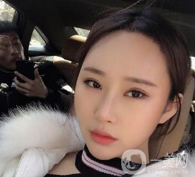 河北省中醫(yī)院整形美容科隆鼻怎么樣？?jī)r(jià)格表及術(shù)后恢復(fù)日記分享