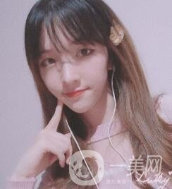 南昌二附院整形科價格表2020，附肋軟骨隆鼻整形案例