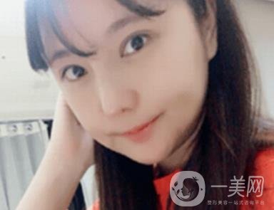 廣州博仕整形醫(yī)院做鼻子多少錢?價格表和整形恢復日記一覽