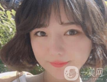 廣州博仕整形醫(yī)院做鼻子多少錢?價格表和整形恢復日記一覽