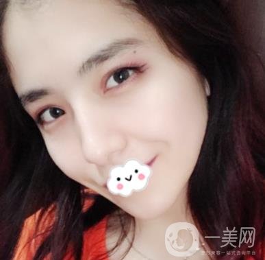 上海伯思立整形怎么樣？附沈國雄隆鼻案例及整形價格表
