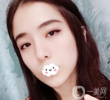 上海伯思立整形怎么樣？附沈國雄隆鼻案例及整形價格表
