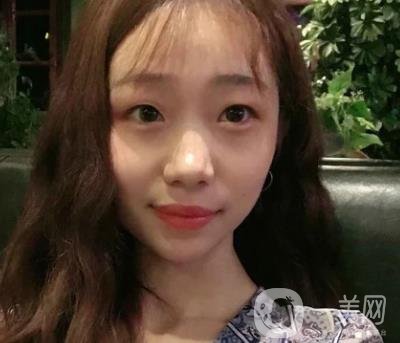 上海華美李志海磨骨多少錢？案例有嗎？整形價(jià)格表一覽