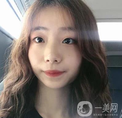 上海華美李志海磨骨多少錢？案例有嗎？整形價(jià)格表一覽