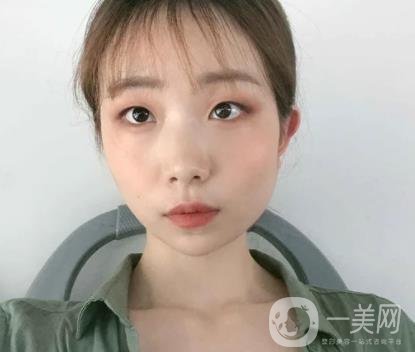 上海華美李志海磨骨多少錢？案例有嗎？整形價(jià)格表一覽