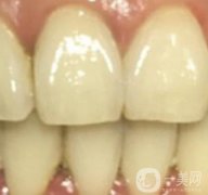 滿莊鎮(zhèn)衛(wèi)生院整牙好嗎？牙齒矯正價格在線一覽