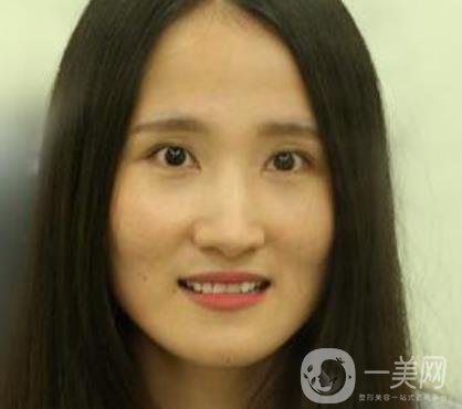 北京市海淀醫(yī)院整牙多少錢？看價(jià)格表及案例*果