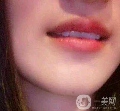 北京市海淀醫(yī)院整牙多少錢？看價(jià)格表及案例*果