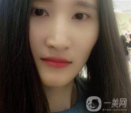 北京市海淀醫(yī)院整牙多少錢？看價(jià)格表及案例*果