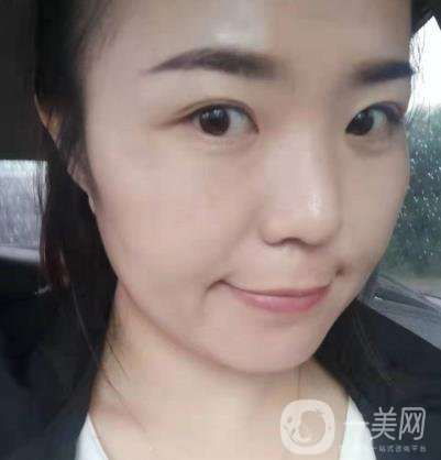 吉大一院整形美容科價(jià)格表費(fèi)用明細(xì)，附祛斑案例