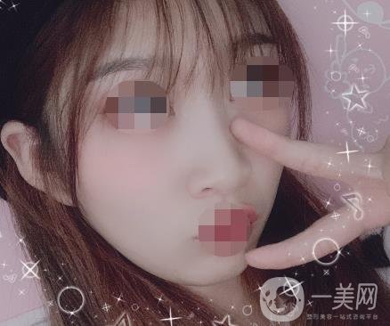 河北省中醫(yī)院整形美容科去疤*果如何？價格表及案例實拍圖公布