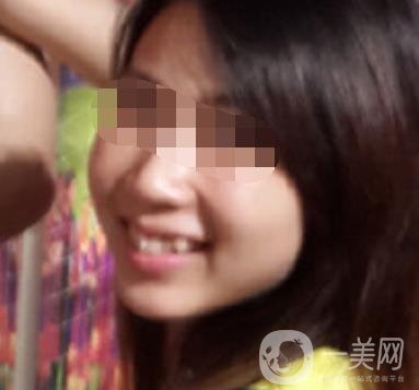 南昌大學第二附屬醫(yī)院整牙60天案例，還有價格表哦