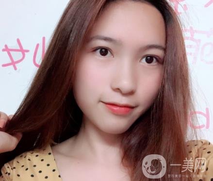 沈陽軍區(qū)總醫(yī)院整形外科價格表2020，附雙眼皮案例