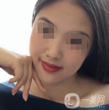 鹽城東方女子整形醫(yī)院價格表_點(diǎn)痣*果一覽