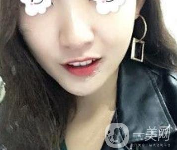浙二醫(yī)院整形美容科價格表*新版，附激光祛斑*終*果圖