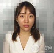 廣州高尚醫(yī)學(xué)美容中心隆鼻價(jià)格表和案例