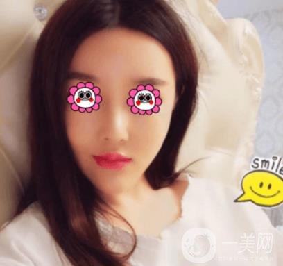 長(zhǎng)沙中南大學(xué)*三醫(yī)院整形美容外科隆鼻多少錢？?jī)r(jià)格表及案例詳情