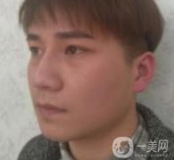 棗莊市立醫(yī)院燒傷整形美容科做光子嫩膚好嗎？?jī)r(jià)格表及術(shù)后果分享