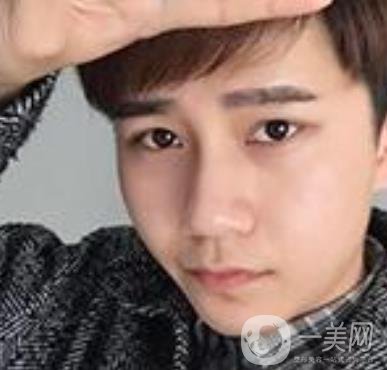 棗莊市立醫(yī)院燒傷整形美容科做光子嫩膚好嗎？?jī)r(jià)格表及術(shù)后*果分享