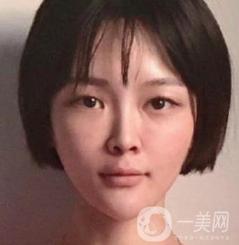 石家莊市醫(yī)院整形美容外科價(jià)格表2020，附雙眼皮實(shí)例