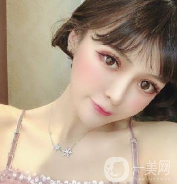 石家莊市醫(yī)院整形美容外科價(jià)格表2020，附雙眼皮實(shí)例