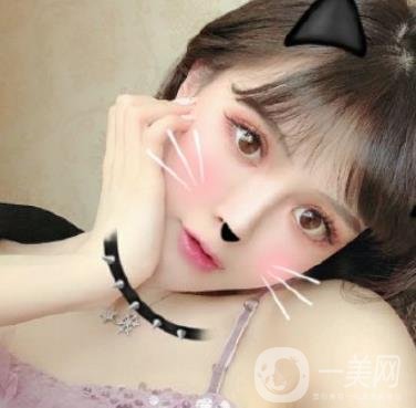 石家莊市醫(yī)院整形美容外科價(jià)格表2020，附雙眼皮實(shí)例