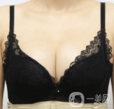 上海美貝爾明橋醫(yī)院價格(目)一覽表，附孫超醫(yī)生隆胸經(jīng)驗分享