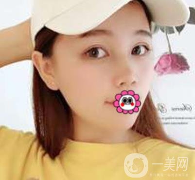 河南省人民醫(yī)院誰(shuí)做雙眼皮好？附案例及2020整形價(jià)格表