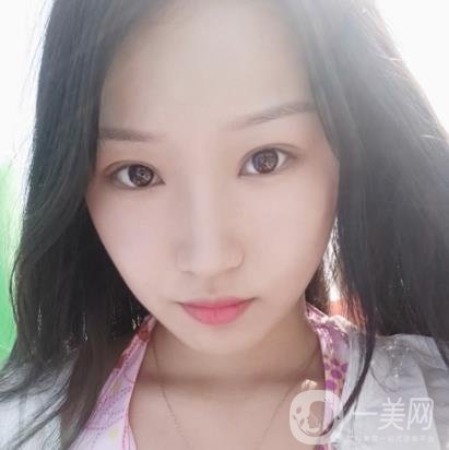 北大醫(yī)院美容價格表，附自體脂肪填充面部前后照