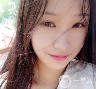 北大醫(yī)院美容價格表，附自體脂肪填充面部前后照