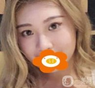 常州一院美容科價(jià)格表，*前后果圖一覽