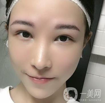成都華美醫(yī)院做眉毛怎么樣?真實(shí)*果圖和價格一覽表展示