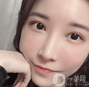 成都華美醫(yī)院做眉毛怎么樣?真實(shí)*果圖和價格一覽表展示