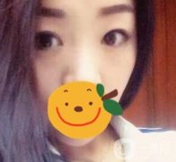 昆明市第一人民醫(yī)院雙眼皮多少錢？附案例及2020全新整形價(jià)格表